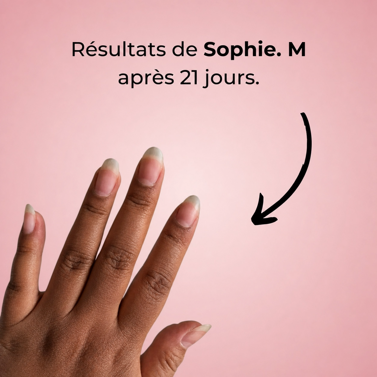 Sérum de Croissance des Ongles