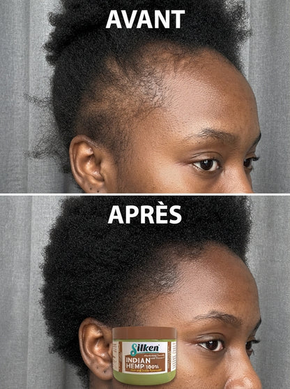 Huile de Croissance Des Cheveux  (Satisfait ou Remboursé)