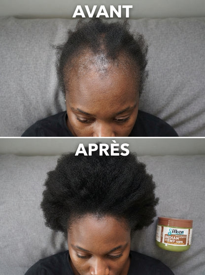 Huile de Croissance Des Cheveux  (Satisfait ou Remboursé)