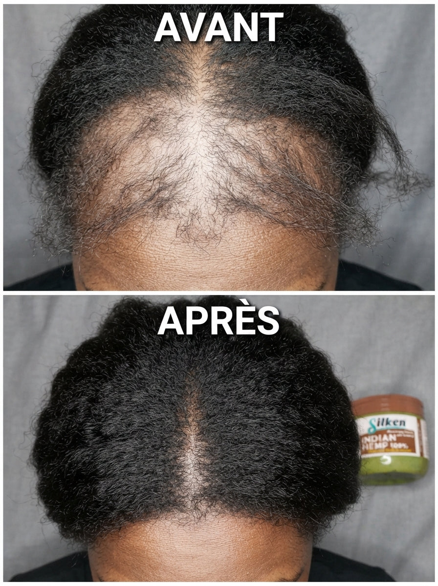 Huile de Croissance Des Cheveux  (Satisfait ou Remboursé)