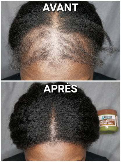 Huile de Croissance Des Cheveux  (Satisfait ou Remboursé)